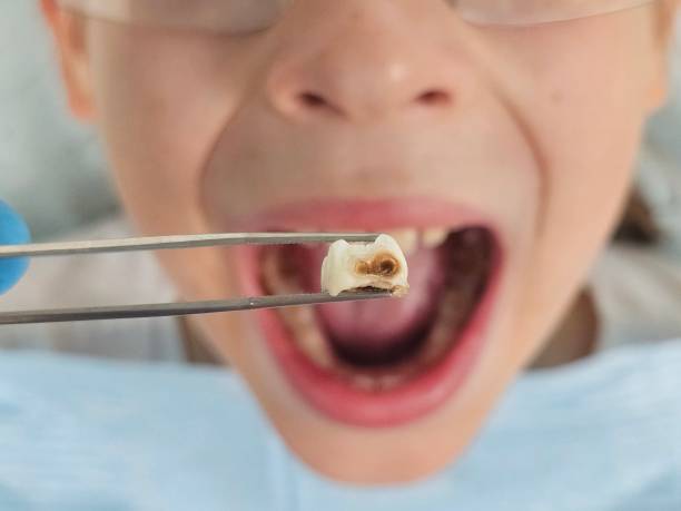 Best Broken Tooth Emergency  in Wickliffe, OH