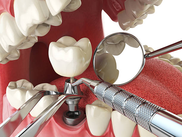 Best Knocked-Out Tooth Emergency  in Wickliffe, OH
